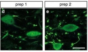 Representative images of DMnX neurons immunostained with an anti-hα-syn antibody from rats treated with (d) hα-syn-AAV prep 1 (e) prep 2