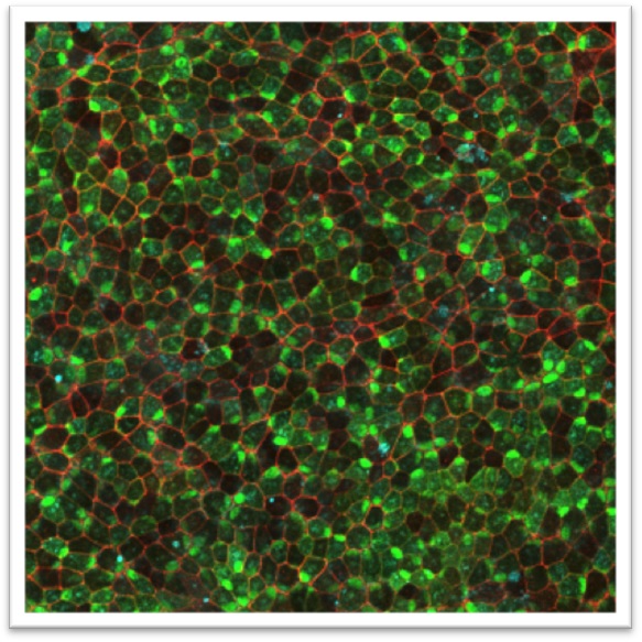 Customized adenoviral vectors (AVs)