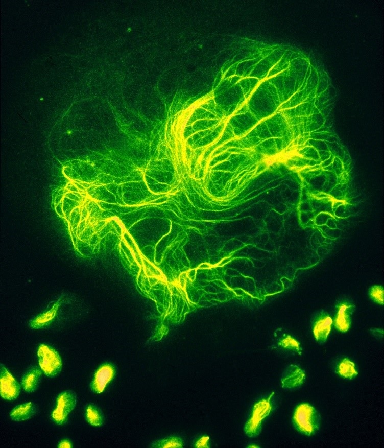 Bachem highlights Dye Labeled Peptides for Cancer Research