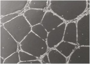 HDMVEC/TERT164 microvascular endothelial cells