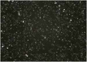 PODO/TERT256 kidney podocytes