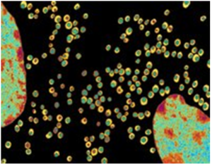 Colored transmission electron micrograph (TEM) of a section through two cells of the hormone-secreting islet of Langerhans in the pancreas (the membrane separating the two cells is not seen). At far left and lower right are parts of the nuclei of these cells. The cells contain membrane-bound secretory granules (circular). These contain a dense granular core of hormone (green) separated from the surrounding membrane by a clear space (yellow). The islets of Langerhans secrete insulin and glucagon hormones into the blood, which control blood sugar levels.