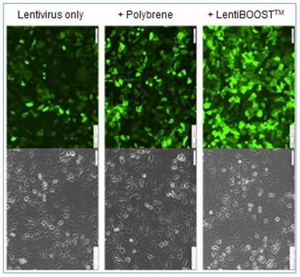 SIRION LentiBOOST™ non-cytotoxic transduction enhancer for lentiviral vectors