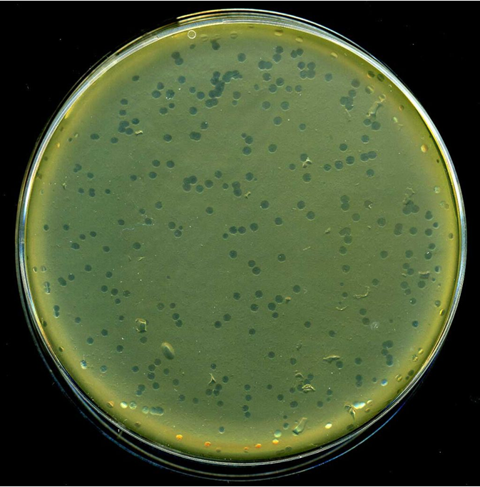 Phage typing of bacteria