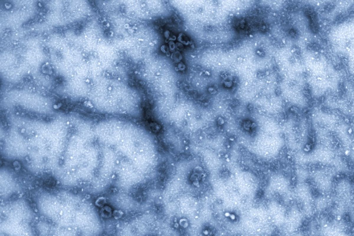Evercyte off-the-shelf extracellular vesicles (EVs)