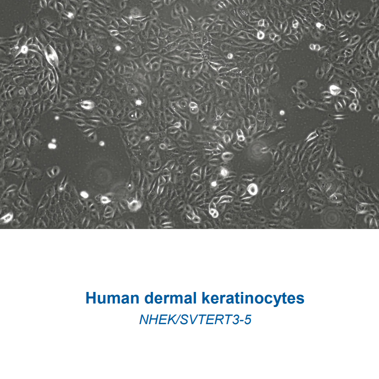 Human Dermal Keratinocytes – NHEK/SVTERT3-5