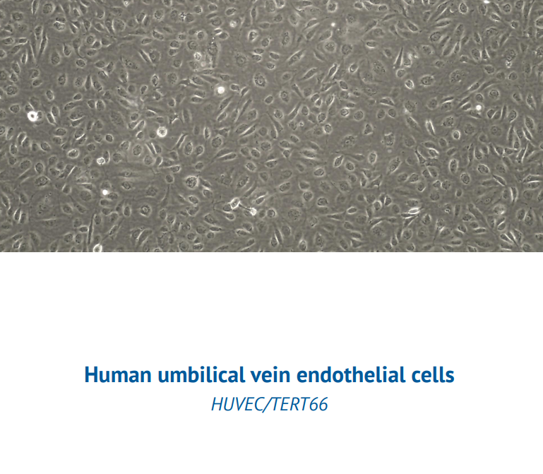 Human umbilical vein endothelial cells – HUVEC/TERT66
