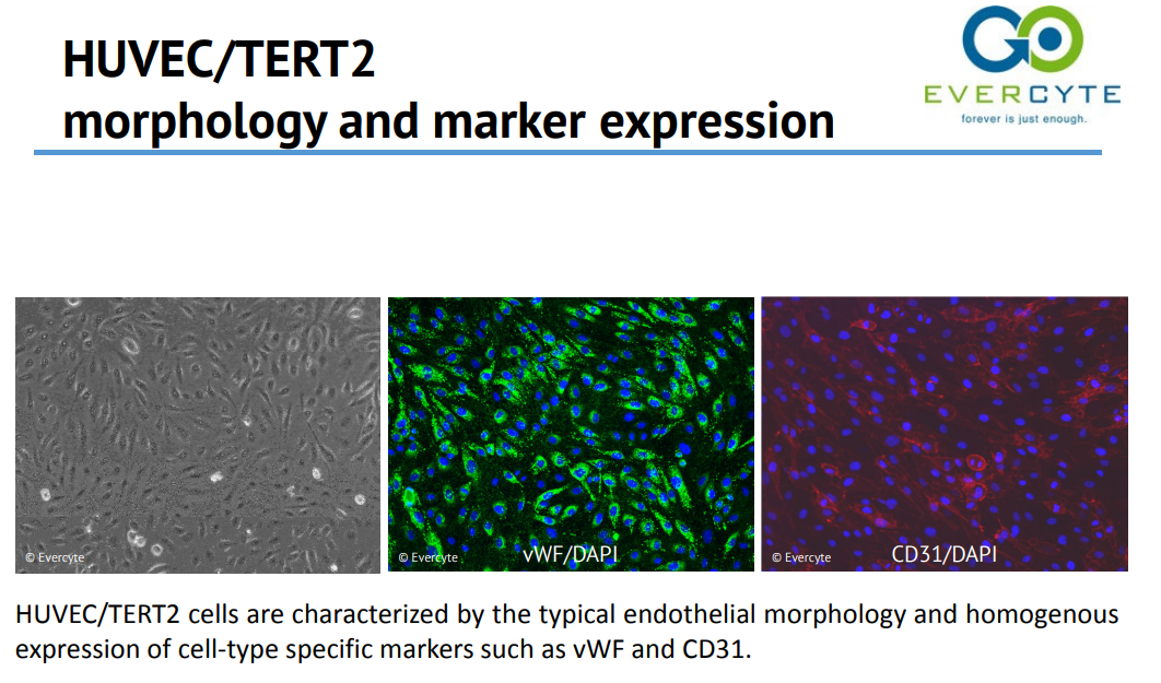 Morphology and marker expression – HUVEC/TERT2
