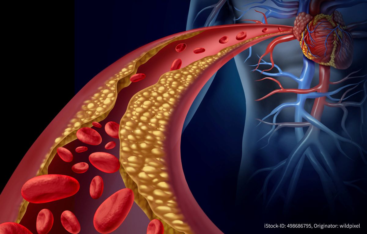 Polypharma marks World Cholesterol Day