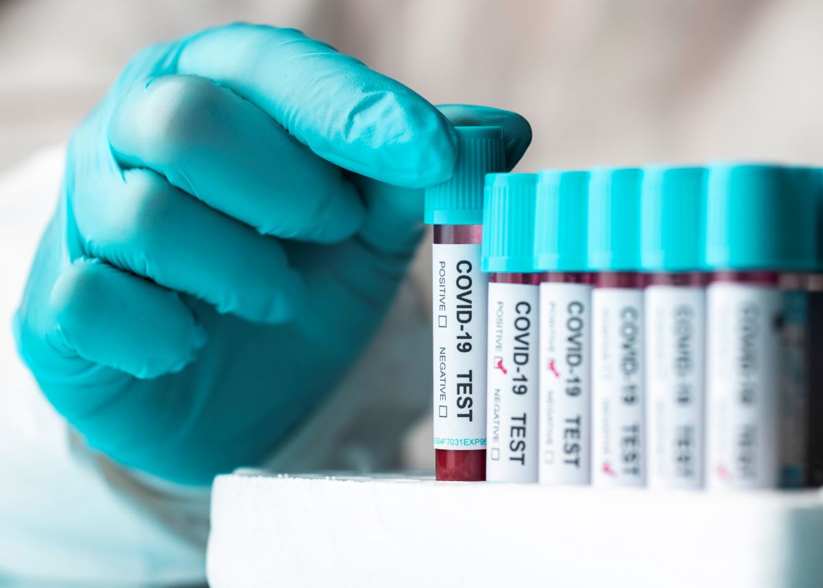 ZELLX® COVID-19 Coronavirus assays