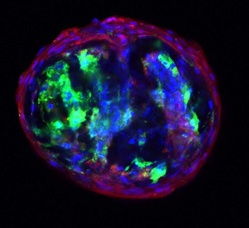 Evercyte helps pioneer standardized production of spheroids for tissue engineering