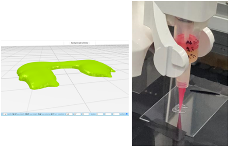 Brinter® 3D bioprinting advances meniscus implant knee repairs